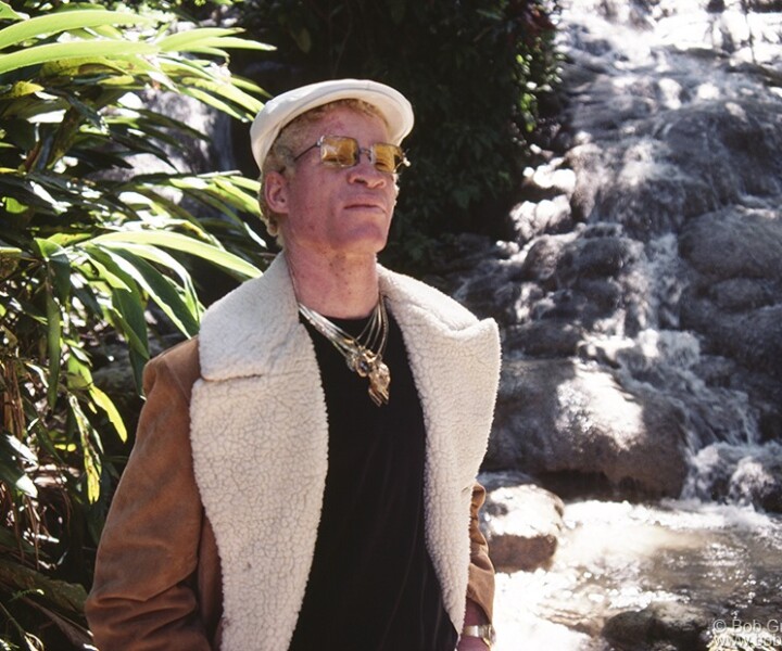 Yellowman, Ocho Rios, Jamaica. January 1984. <P>Image #: Yellowman184_1984_2 © Bob Gruen